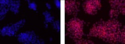 Invitrogen OCT3/4 Monoclonal Antibody (EM92), eFluor 570, eBioscience 25