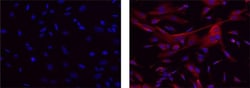 APP (Amyloid Precursor Protein) Monoclonal Antibody (22C11), eFluor&trade; 570, eBioscience&trade;, Invitrogen&trade;