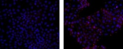 Invitrogen ZO-1 Monoclonal Antibody (R26.4C), eFluor 570, eBioscience 25