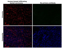 Invitrogen Vimentin Monoclonal Antibody (V9), eFluor 570, eBioscience 25