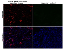 Invitrogen Vimentin Monoclonal Antibody (V9), eFluor 570, eBioscience 25