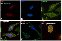 Ki-67 Monoclonal Antibody (20Raj1), eFluor 615, eBioscience , Invitrogen