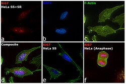 Ki-67 Monoclonal Antibody (20Raj1), eFluor 615, eBioscience , Invitrogen