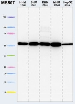 ATP5A1 Monoclonal Antibody (15H4C4):Antibodies, Monoclonal