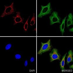 ATP5A1 Monoclonal Antibody (15H4C4):Antibodies, Monoclonal