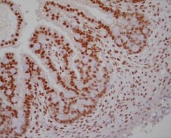 Invitrogen RXRA Monoclonal Antibody (K8508) 100 &mu;L; Unconjugated:Antibodies,