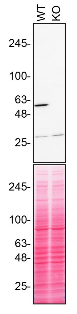Invitrogen RXRA Monoclonal Antibody (K8508) 100 &mu;L; Unconjugated:Antibodies,