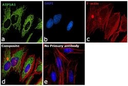 ATP5A1 Monoclonal Antibody (15H4C4):Antibodies, Monoclonal