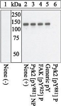 Invitrogen Phospho-PYK2 (Tyr881) Polyclonal Antibody 100 &mu;L | Buy Online | Invitrogen&trade; | Fisher Scientific