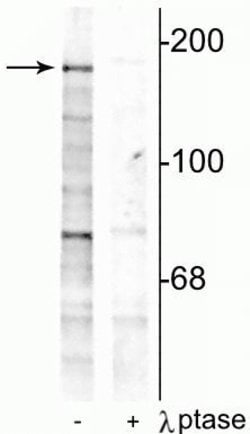 Invitrogen Phospho-NMDAR2B (Tyr1252) Polyclonal Antibody 100 &mu;L; Unconjugated:Antibodies,