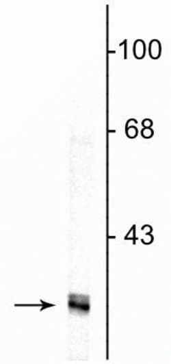 Invitrogen Fibrillarin Monoclonal Antibody (38F3) 100 &mu;L; Unconjugated:Anticorps,