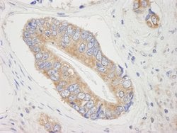 4E-T/eIF4E-T Polyclonal Antibody, Bethyl Laboratories 100 &mu;L; Unconjugated:Antibodies,