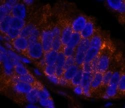 4E-T/eIF4E-T Polyclonal Antibody, Bethyl Laboratories 100 &mu;L; Unconjugated:Antibodies,