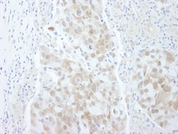 4EBP1 Polyclonal Antibody, Bethyl Laboratories:Antibodies:Primary Antibodies