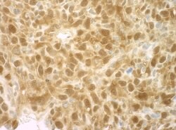 4EBP1 Polyclonal Antibody, Bethyl Laboratories 10 &mu;L; Unconjugated:Antibodies,