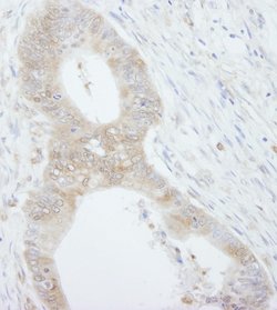 4EBP1 Polyclonal Antibody, Bethyl Laboratories 10 &mu;L; Unconjugated:Antibodies,