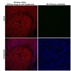 Invitrogen CD20 Monoclonal Antibody (L26), eFluor 660, eBioscience , Invitrogen