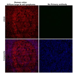 Invitrogen CD20 Monoclonal Antibody (L26), eFluor 660, eBioscience , Invitrogen