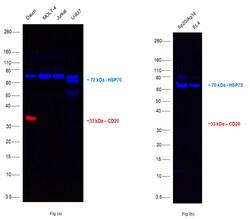 Invitrogen CD20 Monoclonal Antibody (L26), eFluor 660, eBioscience , Invitrogen