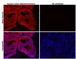 Invitrogen beta Catenin Monoclonal Antibody (15B8), eFluor 660, eBioscience