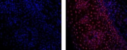 Invitrogen Pokemon (LRF) Monoclonal Antibody (13E9), eFluor 660, eBioscience:Antibodies:Primary