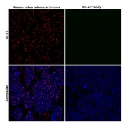 Invitrogen Ki-67 Monoclonal Antibody (SolA15), eFluor 660, eBioscience