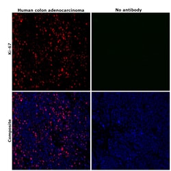 Invitrogen Ki-67 Monoclonal Antibody (SolA15), eFluor 660, eBioscience
