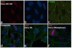 Invitrogen Ki-67 Monoclonal Antibody (20Raj1), eFluor 660, eBioscience:Antibodies:Primary
