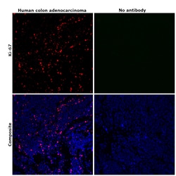 Invitrogen Ki-67 Monoclonal Antibody (20Raj1), eFluor 660, eBioscience:Antibodies:Primary