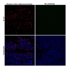 Invitrogen Ki-67 Monoclonal Antibody (20Raj1), eFluor 660, eBioscience:Antibodies:Primary