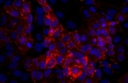 SSEA4 Monoclonal Antibody (eBioMC-813-70 (MC-813-70)), eFluor 660, eBioscience