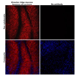 Pan Cytokeratin Monoclonal Antibody (AE1/AE3), eFluor 660, eBioscience