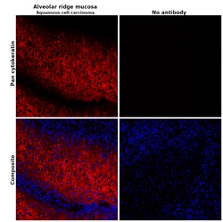 Pan Cytokeratin Monoclonal Antibody (AE1/AE3), eFluor 660, eBioscience