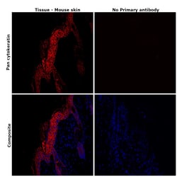Pan Cytokeratin Monoclonal Antibody (AE1/AE3), eFluor 660, eBioscience