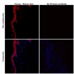 Pan Cytokeratin Monoclonal Antibody (AE1/AE3), eFluor 660, eBioscience