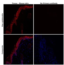 Pan Cytokeratin Monoclonal Antibody (AE1/AE3), eFluor 660, eBioscience