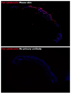 Pan Cytokeratin Monoclonal Antibody (AE1/AE3), eFluor 660, eBioscience