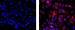 Pan Cytokeratin Monoclonal Antibody (AE1/AE3), eFluor 660, eBioscience