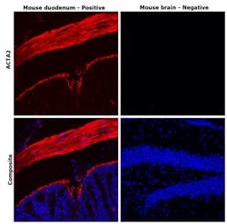 Invitrogen Desmin Monoclonal Antibody (DE-U-10), eFluor 660, eBioscience:Antibodies:Primary