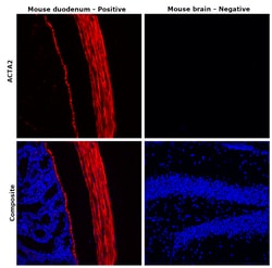 Invitrogen Desmin Monoclonal Antibody (DE-U-10), eFluor 660, eBioscience:Antibodies:Primary