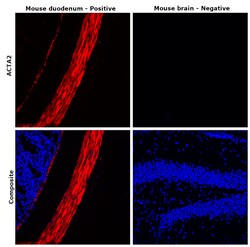 Invitrogen Desmin Monoclonal Antibody (DE-U-10), eFluor 660, eBioscience:Antibodies:Primary