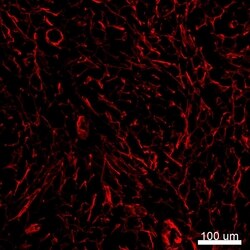 Alpha-Smooth Muscle Actin Monoclonal Antibody (1A4), eFluor 660, eBioscience
