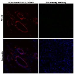 Alpha-Smooth Muscle Actin Monoclonal Antibody (1A4), eFluor 660, eBioscience