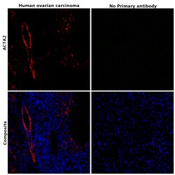 Alpha-Smooth Muscle Actin Monoclonal Antibody (1A4), eFluor 660, eBioscience