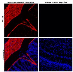 Alpha-Smooth Muscle Actin Monoclonal Antibody (1A4), eFluor 660, eBioscience