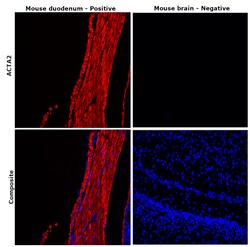 Alpha-Smooth Muscle Actin Monoclonal Antibody (1A4), eFluor 660, eBioscience