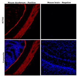 Alpha-Smooth Muscle Actin Monoclonal Antibody (1A4), eFluor 660, eBioscience