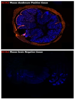 Alpha-Smooth Muscle Actin Monoclonal Antibody (1A4), eFluor 660, eBioscience
