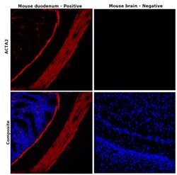 Alpha-Smooth Muscle Actin Monoclonal Antibody (1A4), eFluor 660, eBioscience