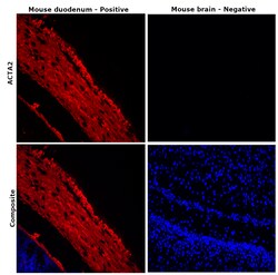 Alpha-Smooth Muscle Actin Monoclonal Antibody (1A4), eFluor 660, eBioscience